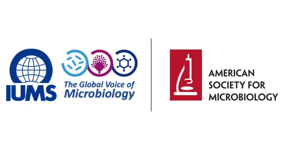 IUMS/ASM Scientific Advisory Group (SAG) report about to be published